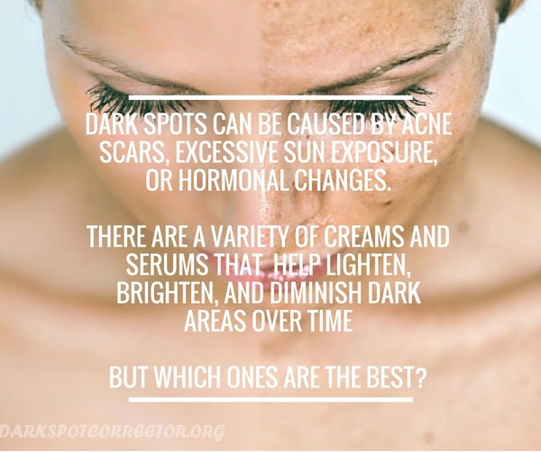Dark spots can be caused by acne, scarring, sun exposure. There are many treatments available but how do you choose?